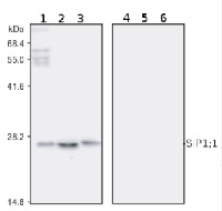 SIP1 | Small basic intrinsic protein 1-1 in the group Antibodies for Plant/Algal / Membrane Transport System / Endomembrane system at Agrisera AB (Antibodies for research) (AS09 495)